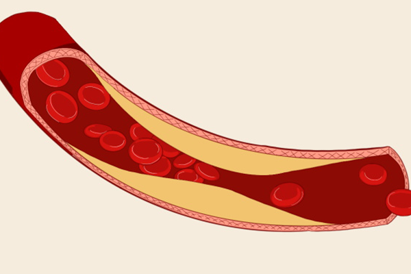 �컨��Ч������ �컨����Щ��Ч������